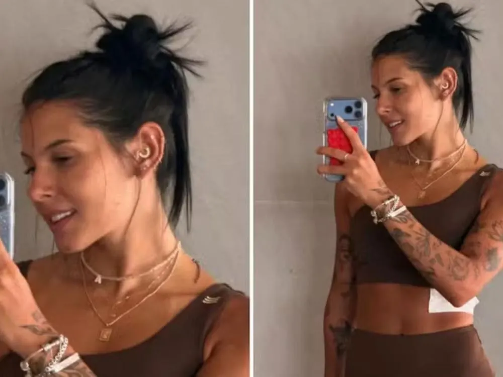 Ana Castela fala sobre fratura na costela, mostra tratamento e mantém discurso confiante