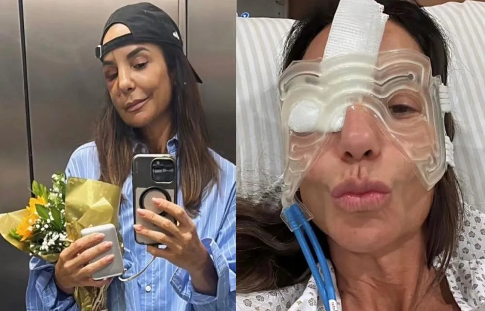 Ivete Sangalo deixa hospital após cirurgia no rosto