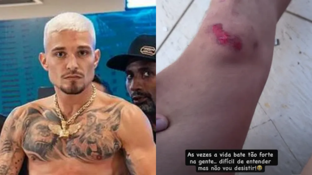 MC Gui enfrenta novo susto após incêndio e relata queda com moto elétrica