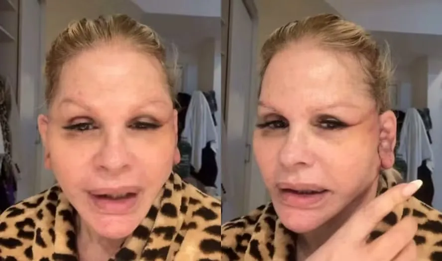 Monique Evans relata dificuldade para ser identificada em banco após procedimento estético